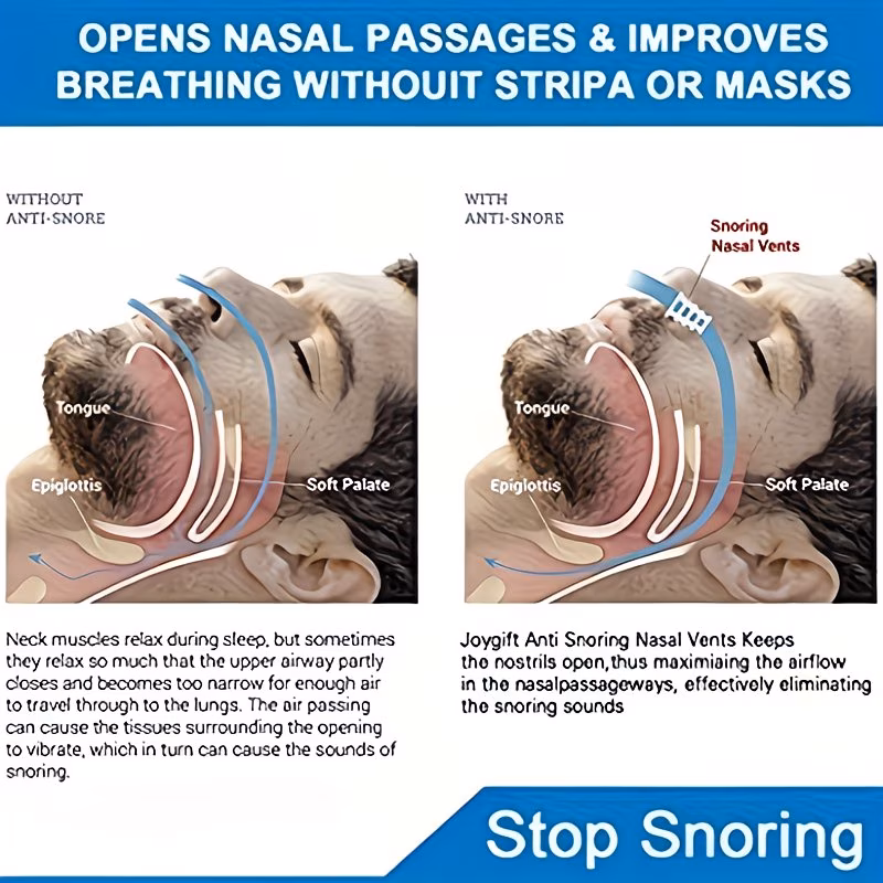 Anti-snoring devices
