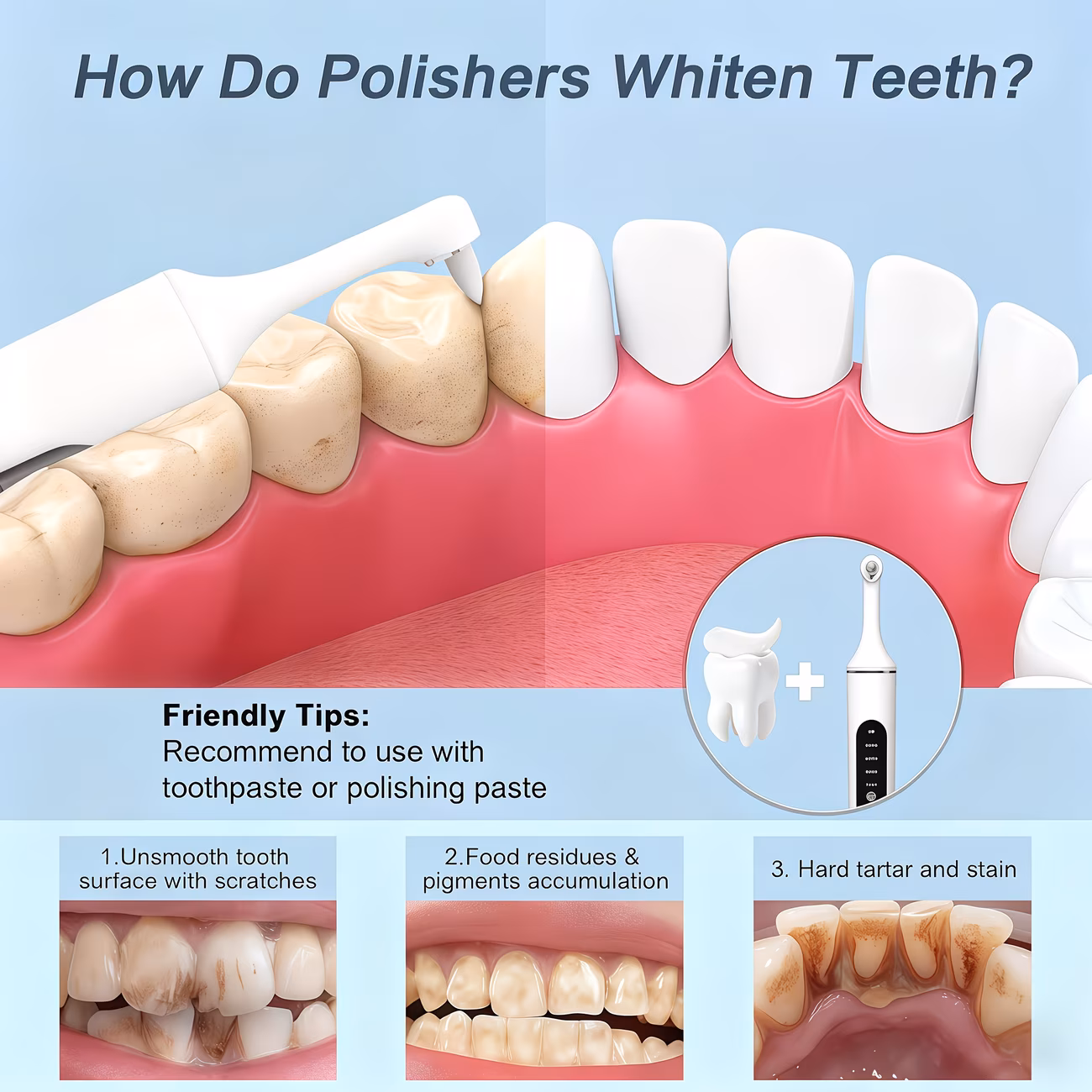 Tooth Polisher