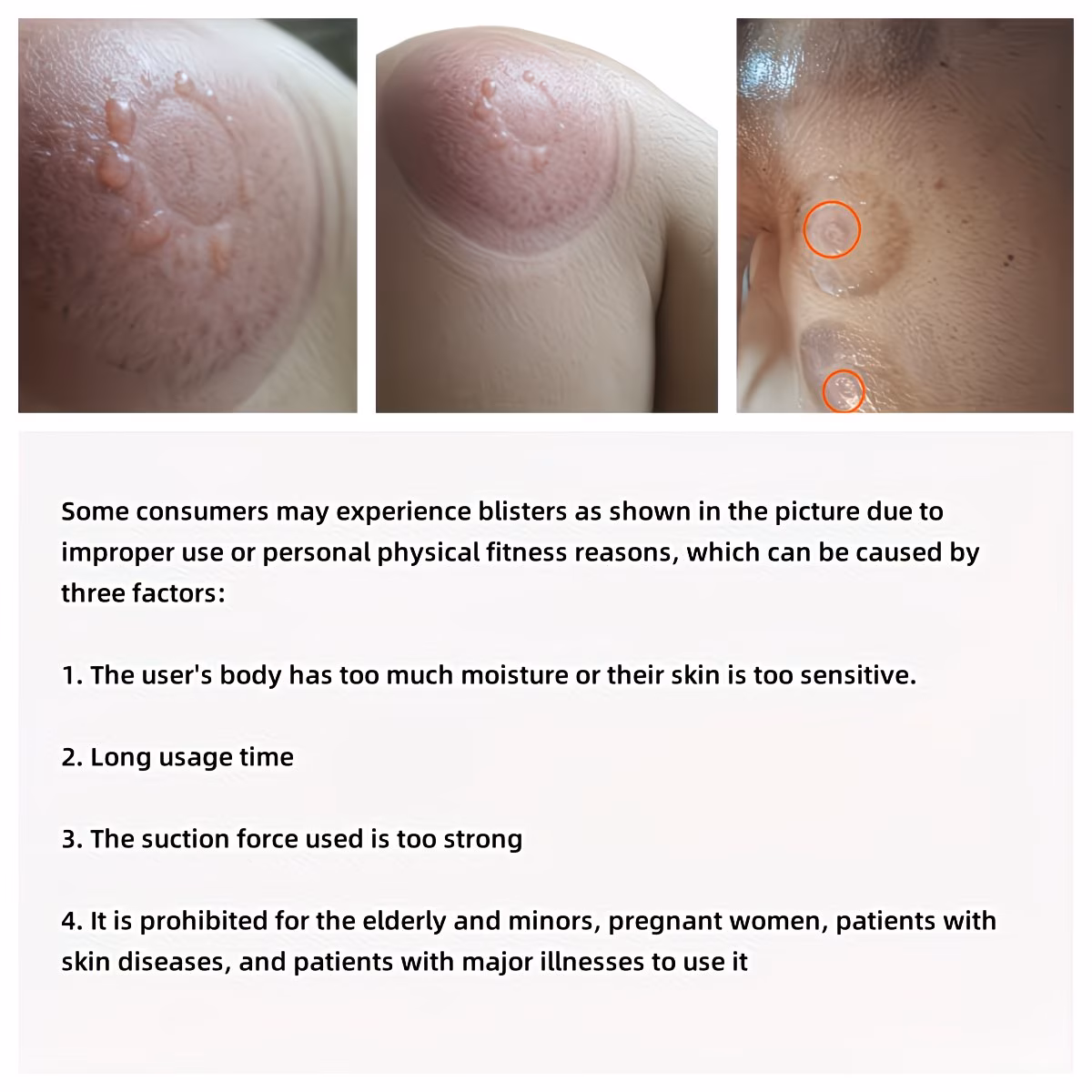 Vacuum cupping massager
