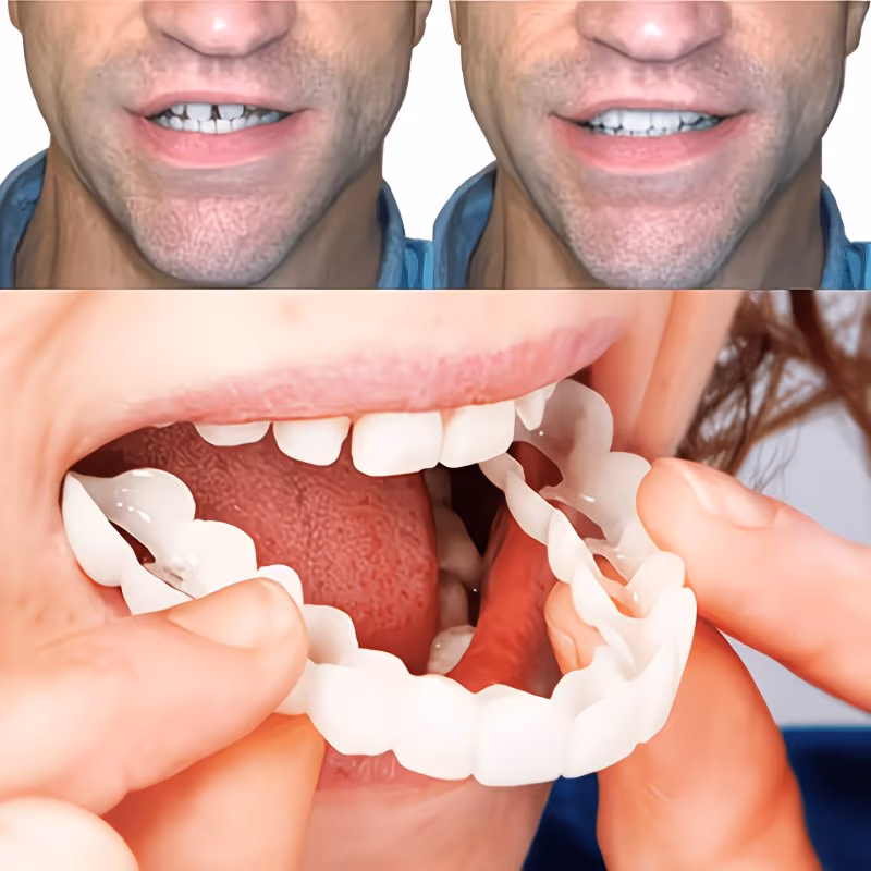  Upper and Lower Dentures