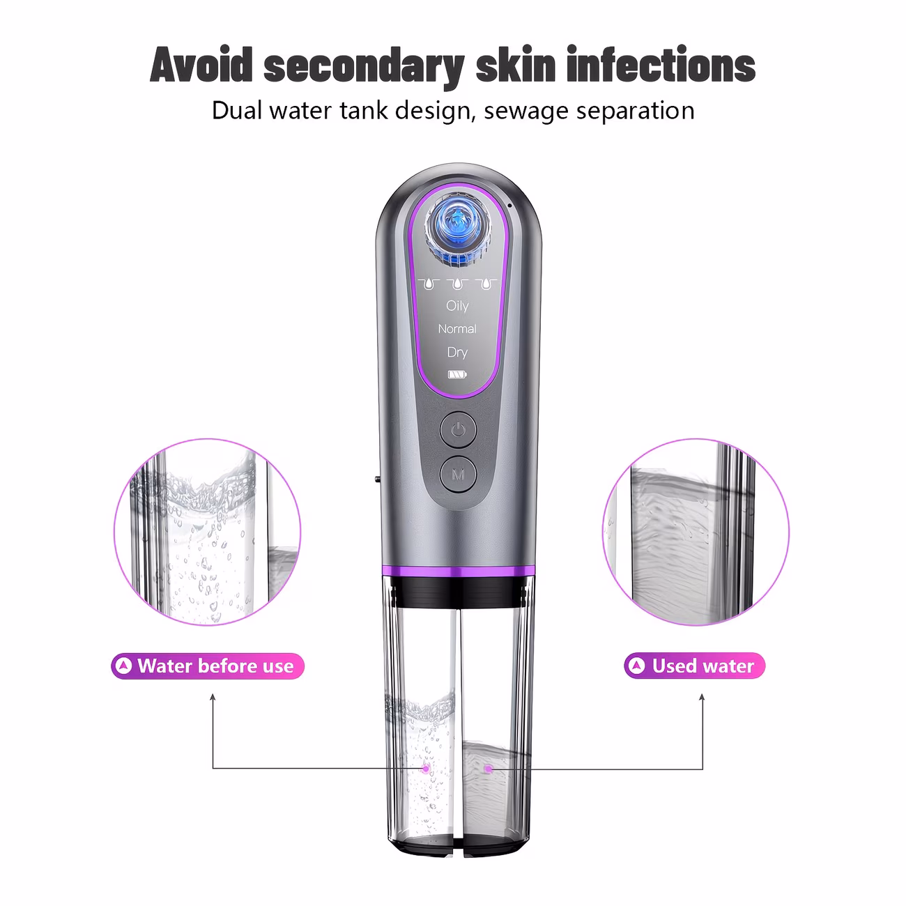Electric Blackhead Remover