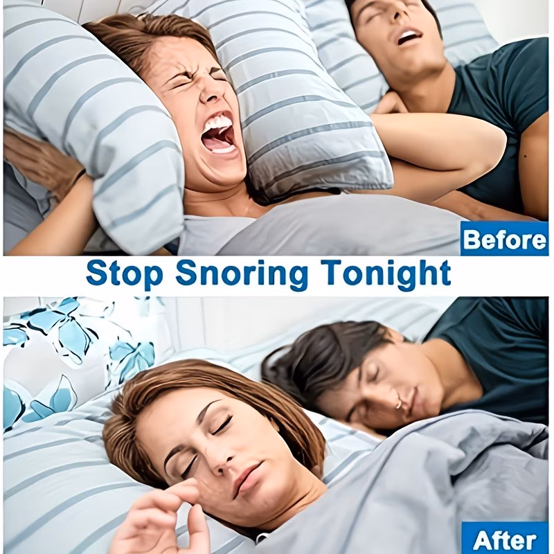 Anti-snoring devices