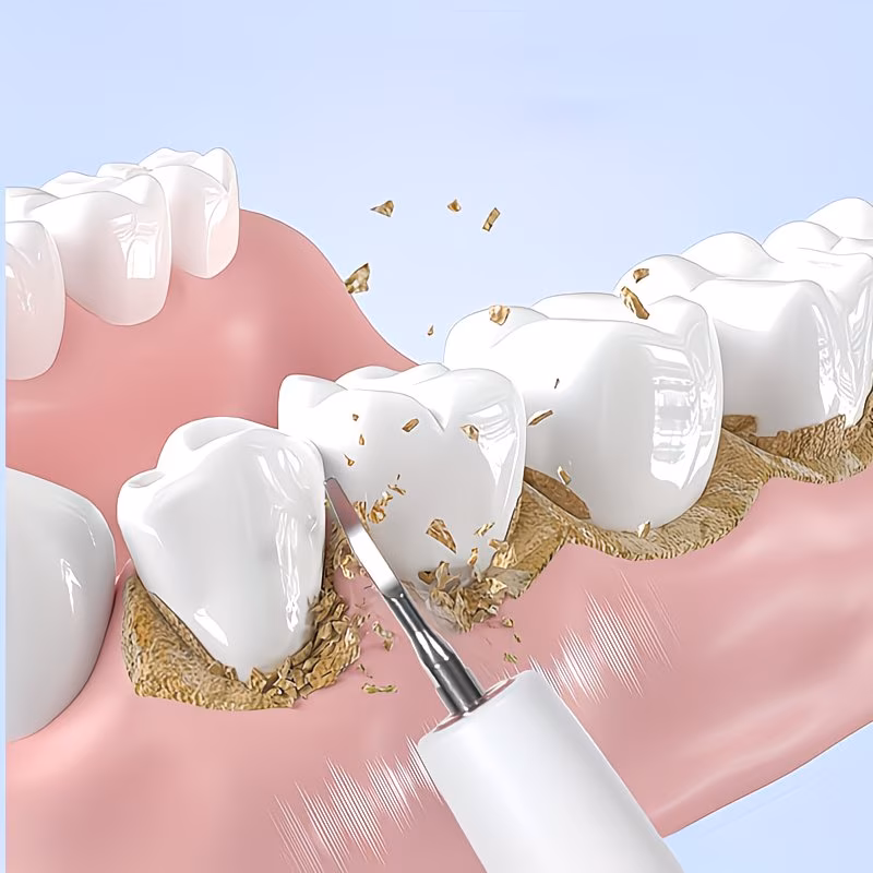 Teeth Cleaning Kit
