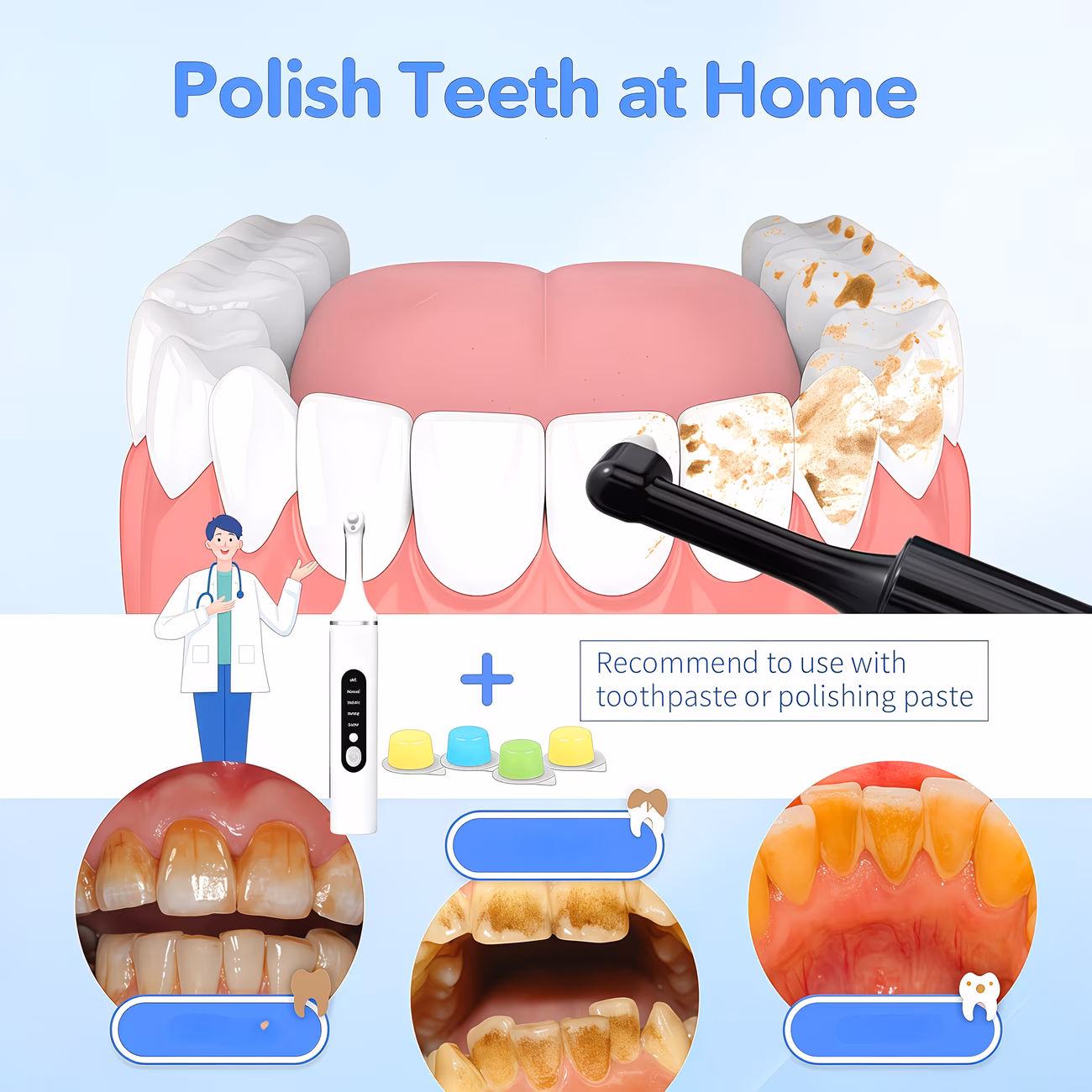 Tooth Polisher