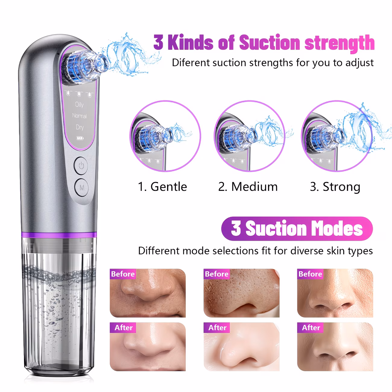 Electric Blackhead Remover